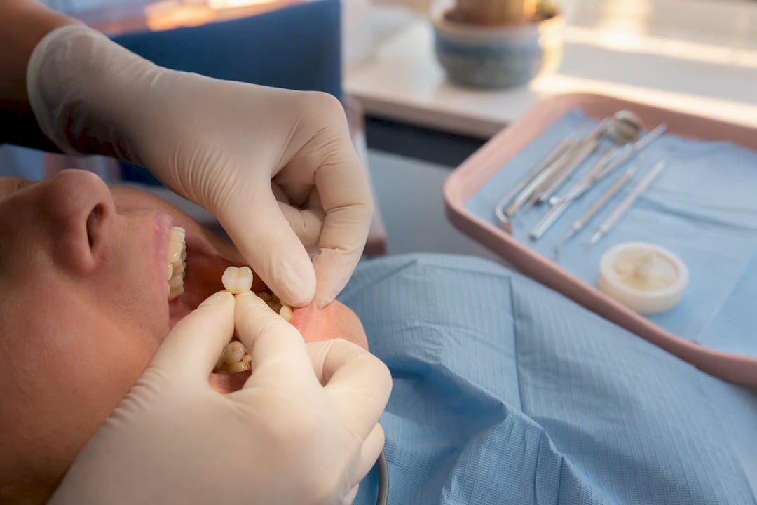 Do I Need a Crown? How to Tell and What Happens Next