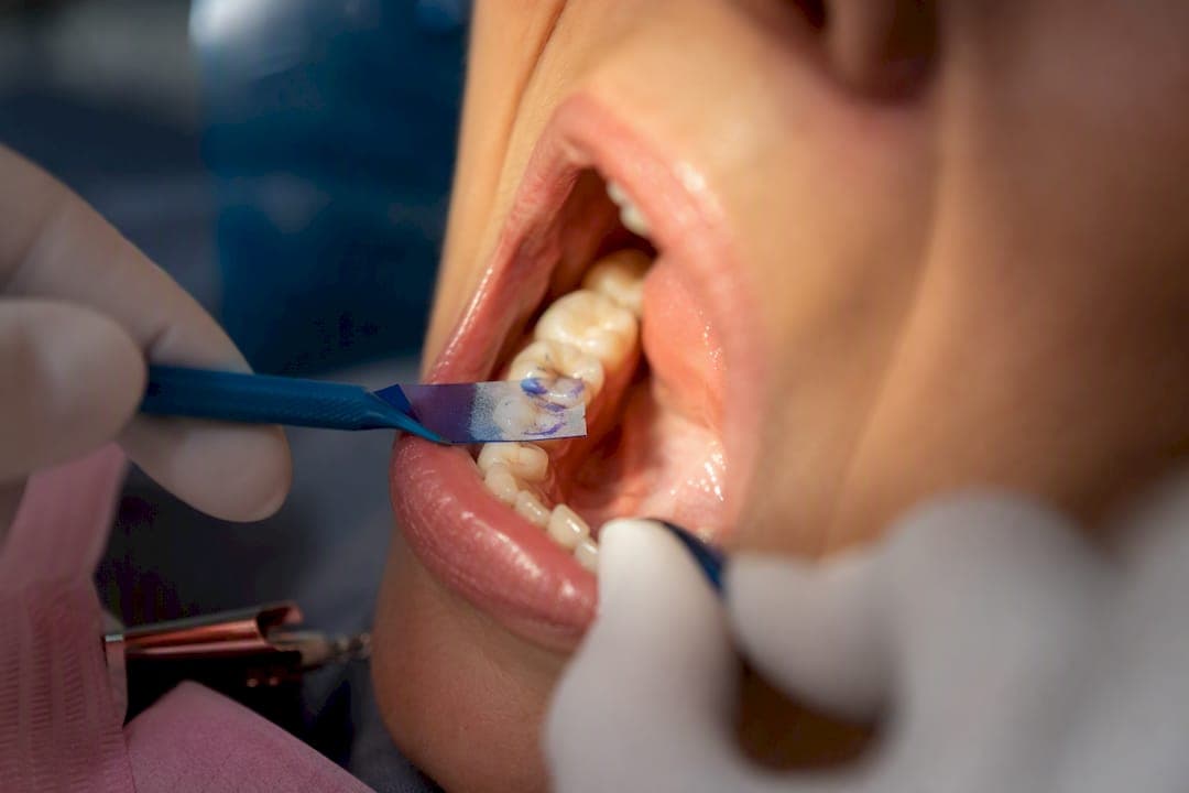 Self Triage for Dental Filling Pain: When to Wait, When to Call