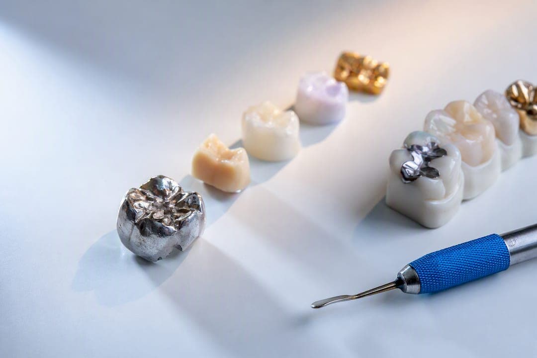 16 vs 11 Years: Types of Dental Fillings Patients Should Ask About