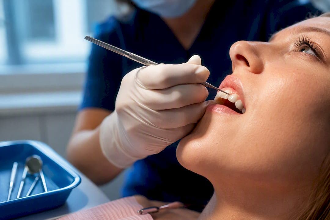 Stages of Gum Disease: What Stages I to IV Mean and How to Spot Them