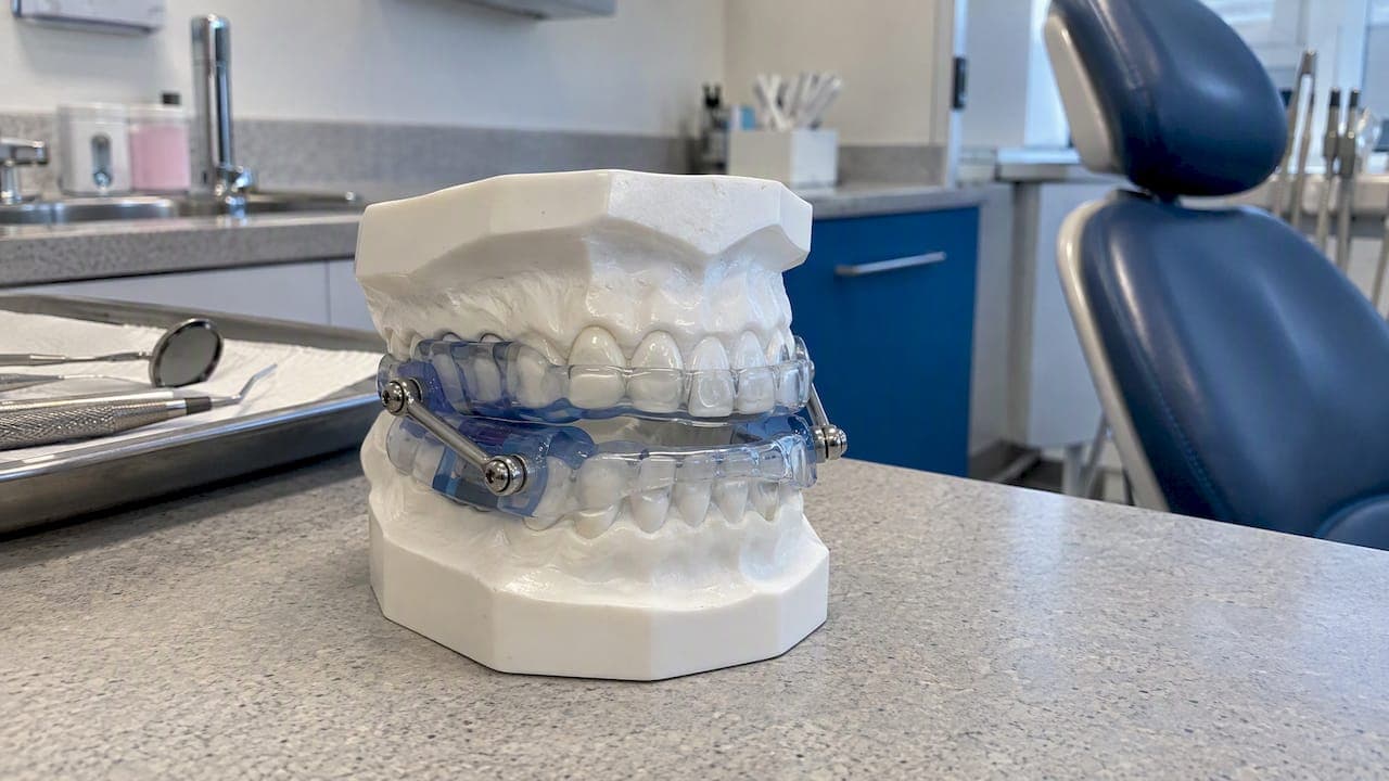Snoring Dentist Treatment: How Oral Appliances Work